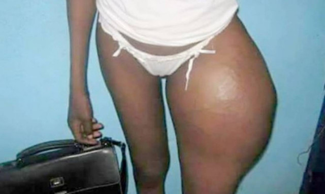 Σοκαριστικές εικόνες: Ήθελε τα οπίσθια της Καρντάσιαν και δείτε πώς έγινε