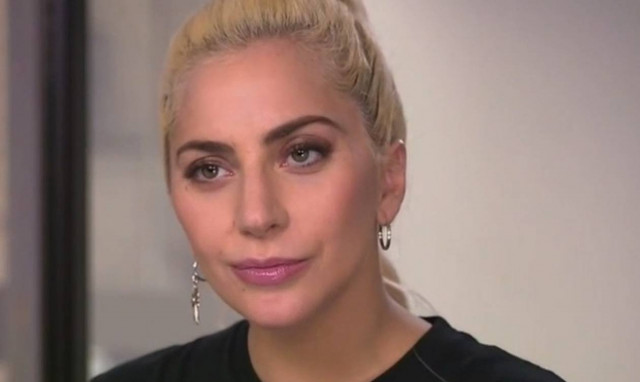 Η εξομολόγηση της  Lady Gaga: «Πάσχω από πνευματική ασθένεια»