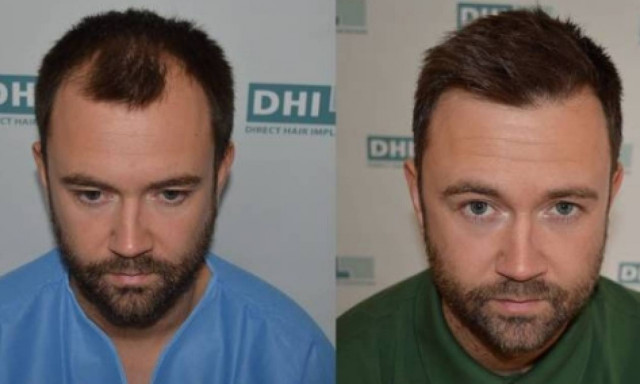 Σώσε τα μαλλιά σου online