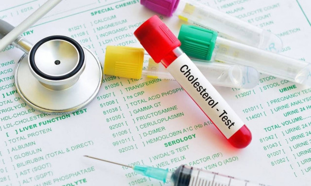 Μέτρηση χοληστερόλης: Επιτρέπεται να φάω πριν την εξέταση;