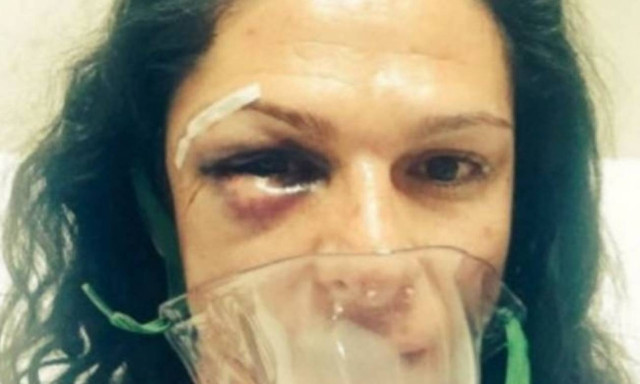 Απίστευτο ξύλο σε Ολυμπιονίκη της Αθήνας!