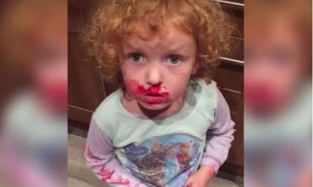 Για όλα φταίει το ξωτικό! (video)