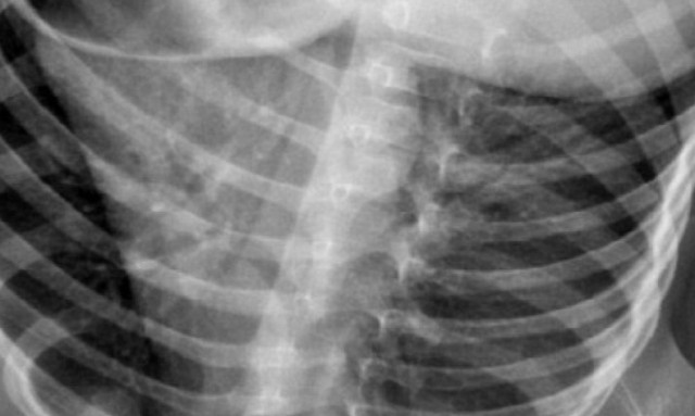 Πύργος: Είδαν την ακτινογραφία και σοκαρίστηκαν - Επιβεβαιώθηκαν οι φόβοι τους (photos)