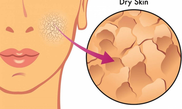 Ξηρή και θαμπή επιδερμίδα: Δέκα χειμωνιάτικες τροφές για άμεση επανόρθωση