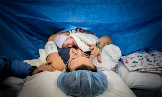 Τρεις αλήθειες για τις μαμάδες που έχουν γεννήσει με καισαρική τομή