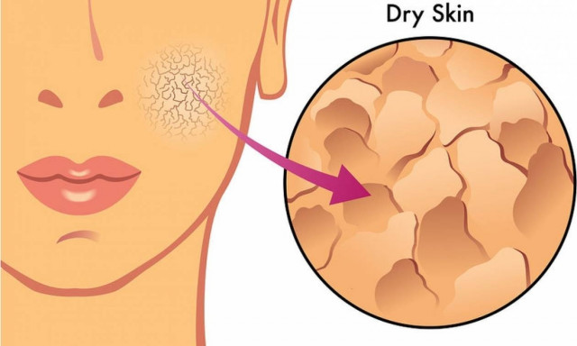 Ξηρή και θαμπή επιδερμίδα: 10 χειμωνιάτικες τροφές για άμεση επανόρθωση