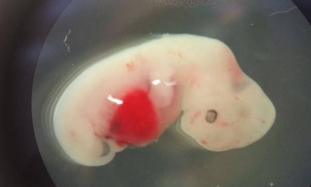 Ανατριχιαστικό: Δημιούργησαν το πρώτο υβρίδιο ανθρώπου με γουρούνι! (video)