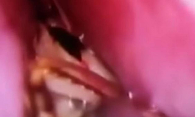 Αντέχετε να δείτε τι ζωντανό αφαίρεσαν από τη μύτη της; (video)