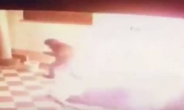 Φρίκη στην Ιταλία: Περιέλουσαν άστεγο με βενζίνη και του έβαλαν φωτιά (ΠΡΟΣΟΧΗ! ΣΚΛΗΡΕΣ ΕΙΚΟΝΕΣ)