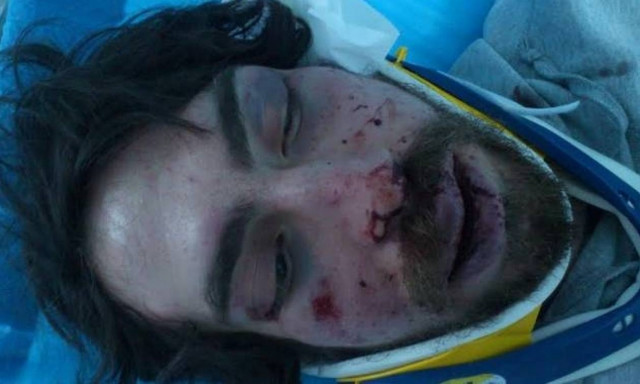 Συνελήφθη 42χρονος για τον ξυλοδαρμό του φοιτητή από κουκουλοφόρους