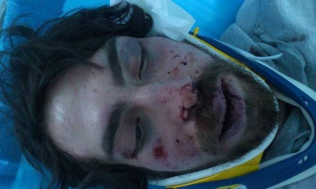 University student hospitalized after being beaten, possibly by Golden Dawn members