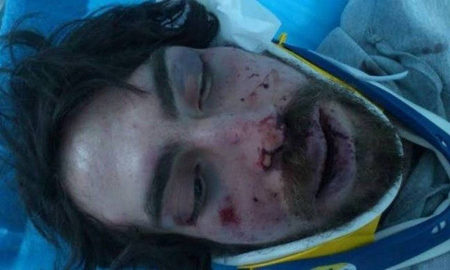 Forty two year old café owner alleged to be involved in the beating and injury of student arrested