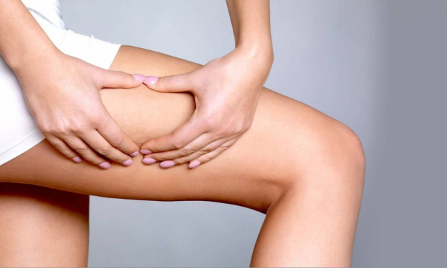 Θεραπεία κυτταρίτιδας 3D-Lipo cavitation