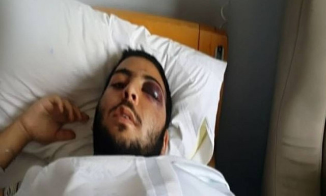 Τρόμος στο Γκάζι: Άγριος ξυλοδαρμός 17χρονου έξω από νυχτερινό κέντρο (vid)