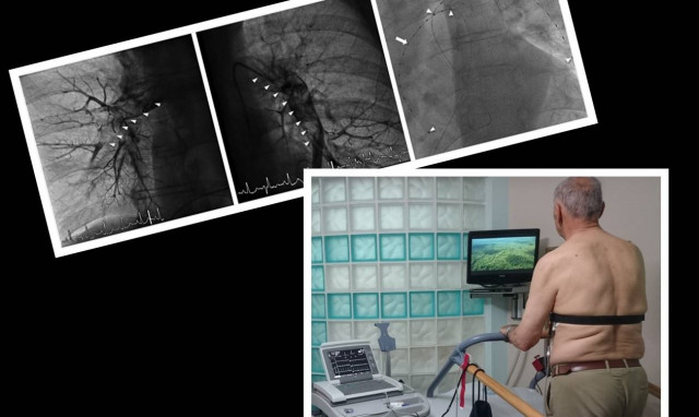 ΣΟΚ: Νεκρός γνωστός Έλληνας επιχειρηματίας μετά από λιποαναρρόφηση