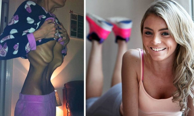 Η δύναμη της θέλησης: 40 «πριν και μετά» φωτογραφίες που θα σας πείσουν ότι όλα είναι δυνατά