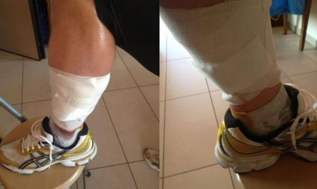 Και δεύτερη επίθεση από σκυλιά στη Λαμία: Θύμα γνωστός αθλητής (pic)