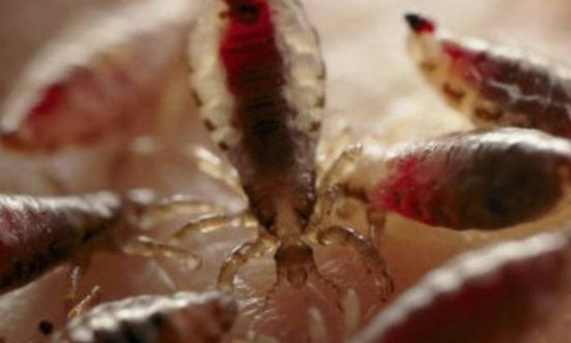 Αυτό είναι το πιο αηδιαστικό βίντεο στον κόσμο – Αντέχετε να το δείτε;