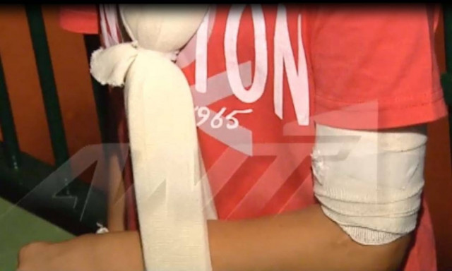 Γαλάτσι - Σοκάρει ο πατέρας του 10χρονου: «Το παιδί έχει ακόμα τη βολίδα μέσα στο χέρι του» (vid)