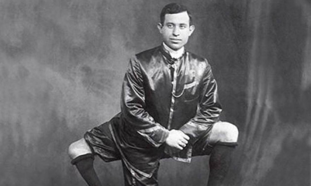 Σαν σήμερα το 1966 «έφυγε» ο Φραντζέσκο Λεντίνι, ο άνδρας με τα 3 πόδια και τα 2 γεννητικά όργανα