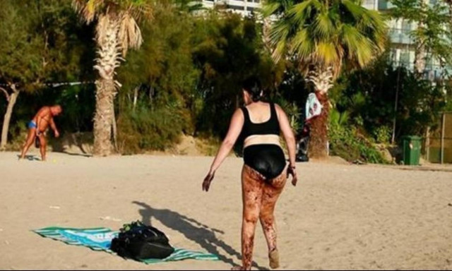 Πετρελαιοκηλίδα: Η οργισμένη απάντηση του Βέλγου φωτογράφου στην Αυλωνίτου για τα περί photoshop