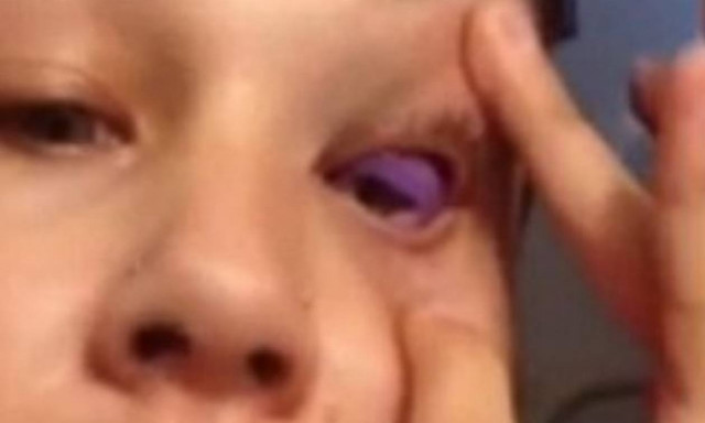 Σοκ: Παραλίγο να χάσει το φως της εξαιτίας ενός τατουάζ (vid)