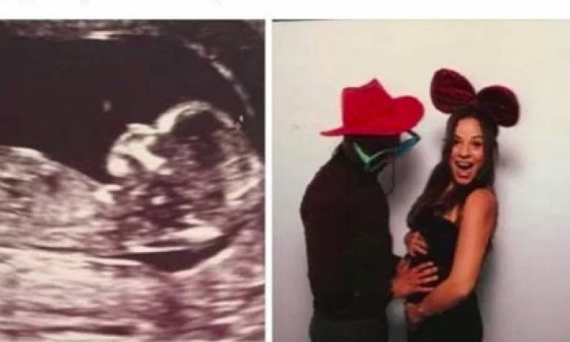 Αποκάλυψη: Ηθοποιός κέρδισε τον Καρκίνο και περιμένει παιδάκι