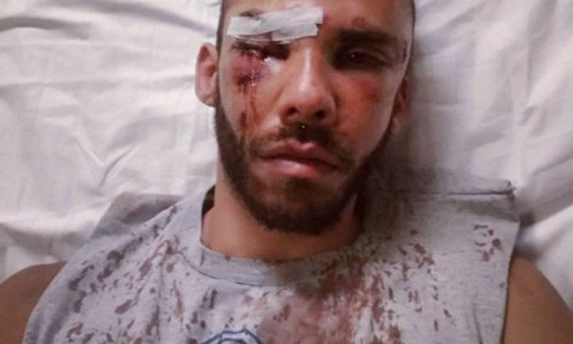 Ανατροπή στην υπόθεση του άγριου ξυλοδαρμού του φοιτητή στο Ρέθυμνο