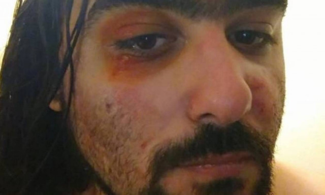 Στην πατρίδα του Λεωνίδα, το «Μολών Λαβέ» τιμωρείται με ξύλο!