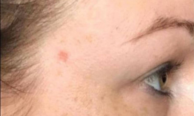 ΣΟΚ! Ανέβασε αυτό το σημάδι στο Facebook - Όταν έμαθε τι είναι, μπήκε στο χειρουργείο