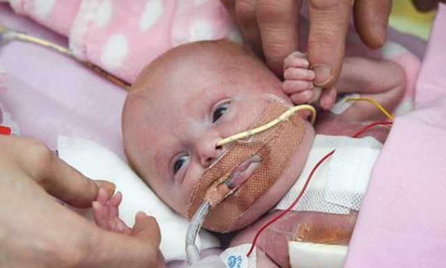 Γνωρίστε μία μεγάλη αγωνίστρια της ζωής που γεννήθηκε με εξωτερική καρδιά - Το βίντεο συγκλονίζει