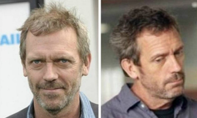 Πώς θα αποκτήσετε πλούσια, πυκνά μαλλιά χωρίς μεταμόσχευση μαλλιών!