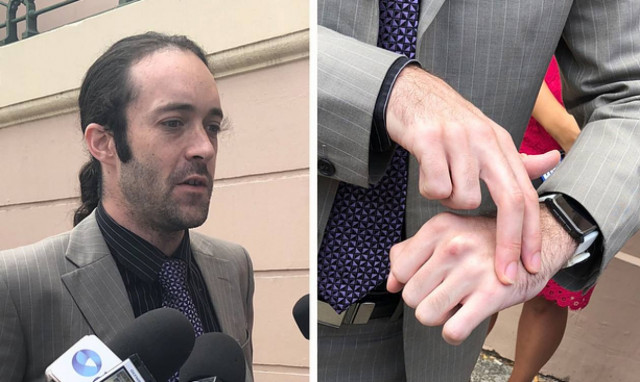 «Τρελός» επιστήμονας εμφύτευσε τσιπάκι στο χέρι του για να μπαίνει στο μετρό! (pics)