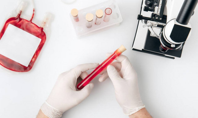 Αιματοκρίτης: Πότε χρειάζεται η εξέταση – Ποιες είναι οι φυσιολογικές τιμές