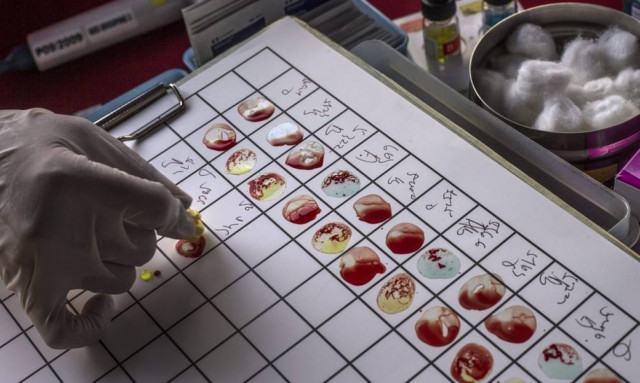 Έκκληση ΕΟΦ για να μην «ξεμείνει» η χώρα από προϊόντα πλάσματος και ανοσοσφαιρίνες