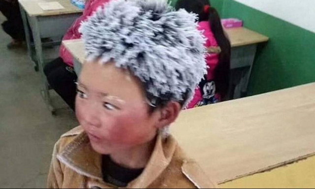 Τι απέγινε το «αγόρι με τα παγωμένα μαλλιά»