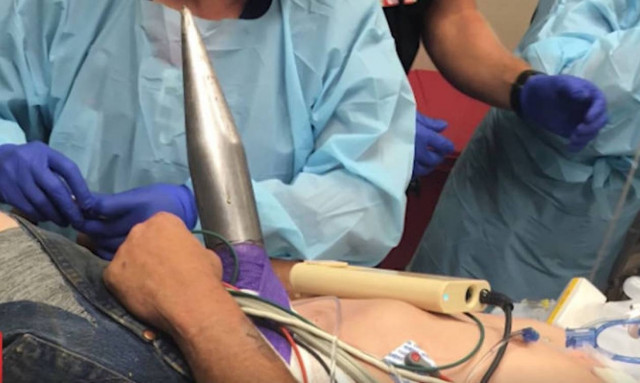 Από τύχη ζει: Σίδερο 18 κιλών διαπέρασε το σώμα του