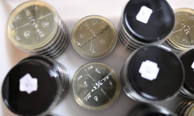 Το ΚΕΕΛΠΝΟ για τη «νόσο των λεγεωναρίων»: Πώς μεταδίδεται και ποια είναι τα μέτρα πρόληψης