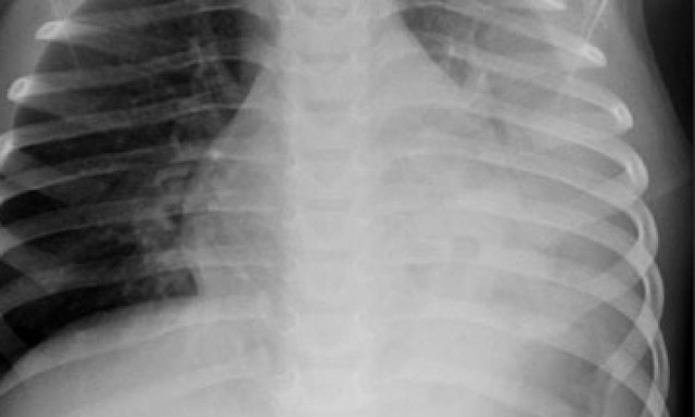 Βόλος: Δεν πίστευαν στα μάτια τους μόλις είδαν την ακτινογραφία του 4χρονου! Σοκαρισμένοι οι γονείς