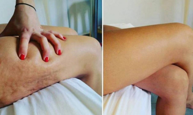 Αυτό το insta account θα σε κάνει να αγαπήσεις το σώμα σου ακριβώς όπως είναι!