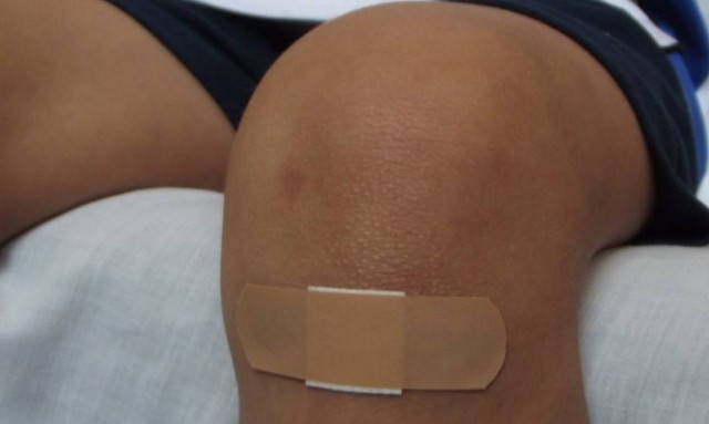 Απίστευτο: Επιστήμονες βρήκαν τρόπο να μετατρέπουν ανοιχτά τραύματα απευθείας σε νέο δέρμα!