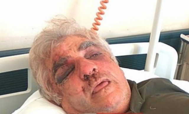 Απίστευτης αγριότητας ληστεία στην Κεφαλονιά: «Μας χτυπούσαν άγρια με σιδερένιες μαγκούρες» (vid)