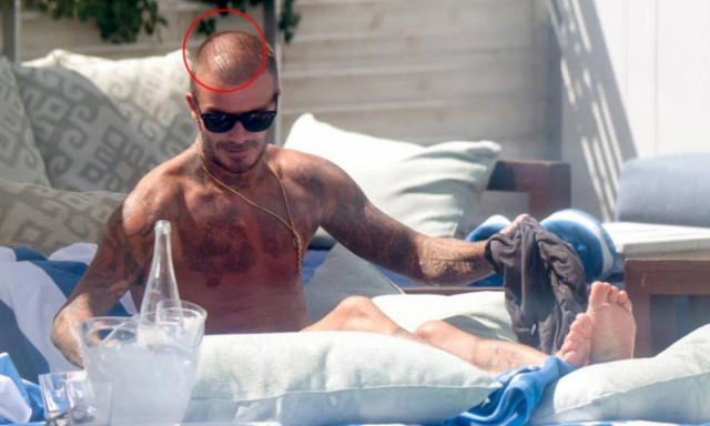 Oups! Τι συνέβη στα μαλλιά του David Beckham;