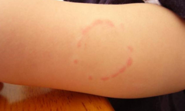 Βόλος: 74χρονος δάγκωσε τη σύζυγό του και επενέβη ο γιος τους με γροθιές!