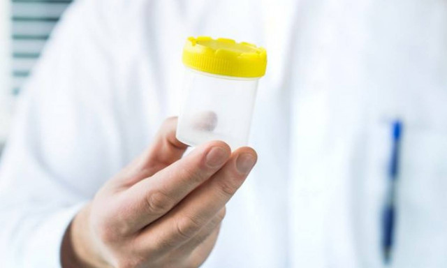 Ποια «βιβλική καταστροφή»; Αυτός είναι ο απίστευτος λόγος που πλησιάζει το τέλος της ανθρωπότητας!