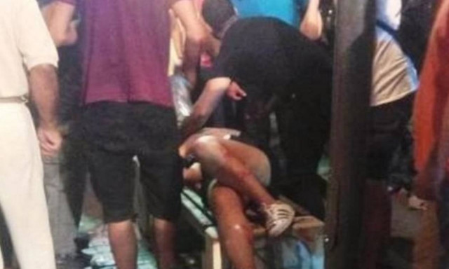 Αγρίνιο: Στα ίχνη του δράστη η ΕΛ.ΑΣ. για τον τραυματισμό 19χρονης από φωτοβολίδα