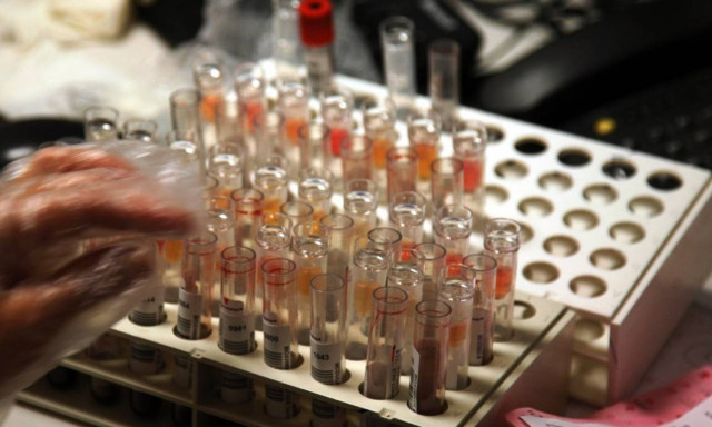 Προσοχή: Τι αλλάζει στην ημερομηνία εκτέλεσης των παραπεμπτικών του ΕΟΠΥΥ για εξετάσεις