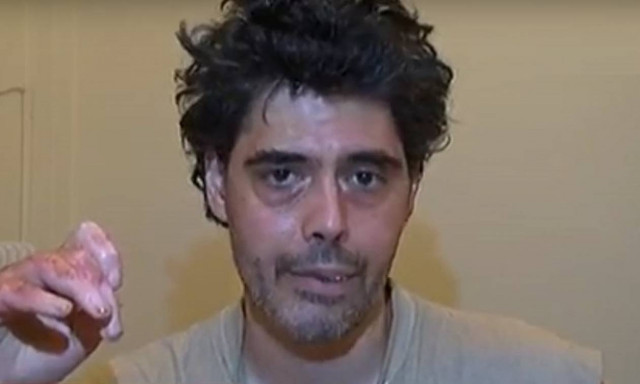 Φωτιά Μάτι: Συγκλονίζει η μαρτυρία 37χρονου επιζώντα που πέρασε μέσα από τις φλόγες (vid)