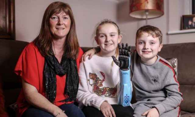 Τα πιο γλυκά Χριστούγεννα: Ανώνυμος δωρητής χαρίζει σε 11χρονη χωρίς άνω άκρο ένα βιονικό χέρι