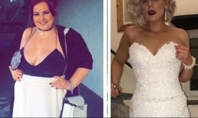 Τρομερή μεταμόρφωση: Έχασε 57 κιλά και σήμερα μοιάζει με μοντέλο! (pic)
